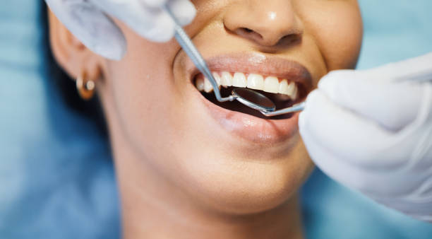 Best Emergency Wisdom Tooth Extraction in Lemont Furnace, PA