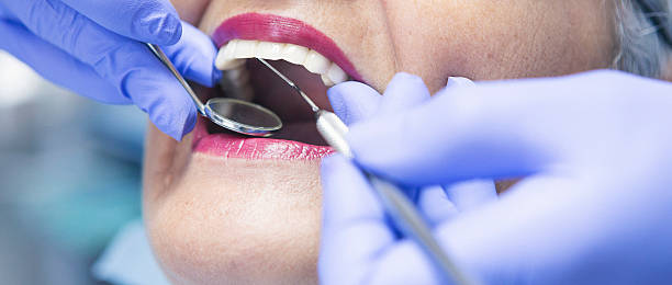 Best Broken or Chipped Tooth Repair in Lemont Furnace, PA